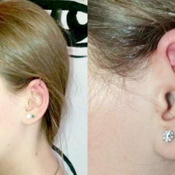 Пирсинг ушей
                    Тату-студия VeAn Tattoo White Одеса