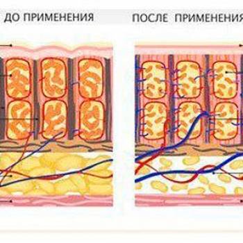 Рина Солнцева , Одесса Фото - 11