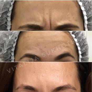 Фото с портфолио Виталия Сухоцка 