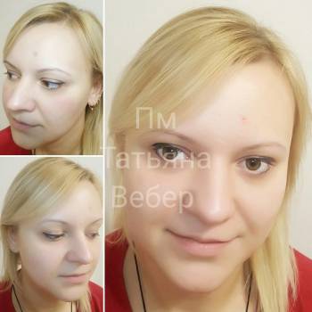 Татуаж век (стрелочки) сразу после процедуры.