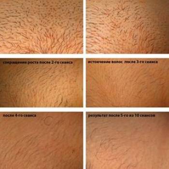 Фото с портфолио Ирина Мельниченко 