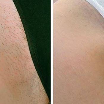 Фото с портфолио Ирина Мельниченко 