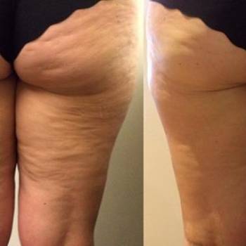 Фото с портфолио Ирина Мельниченко 