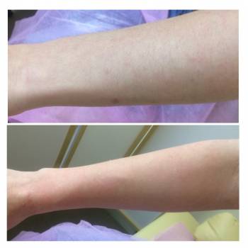 Фото с портфолио Екатерина Бойко 