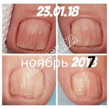 Фото с портфолио Анна 