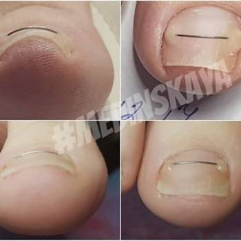 Фото с портфолио Анна 