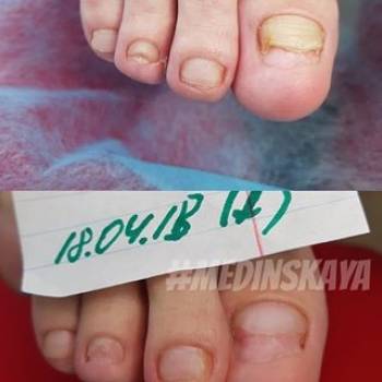 Фото с портфолио Анна 