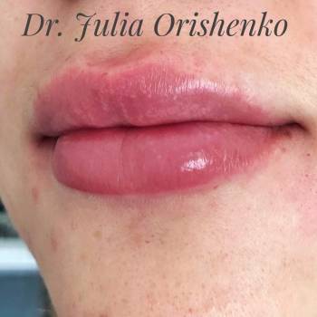 Юлия Орищенко , Днепр Фото - 6