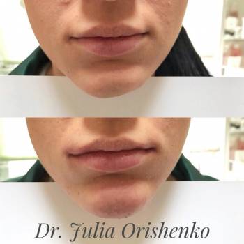 Юлия Орищенко , Днепр Фото - 7