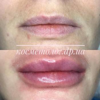 Юлия Орищенко , Днепр Фото - 8