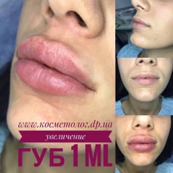 Юлия Орищенко , Днепр Фото - 9