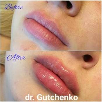 Увлажнили+придали четкость контуру губ= эффект "нацелованных