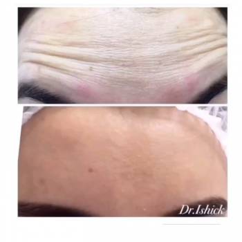 Ольга Ищик , Днепр Фото - 6