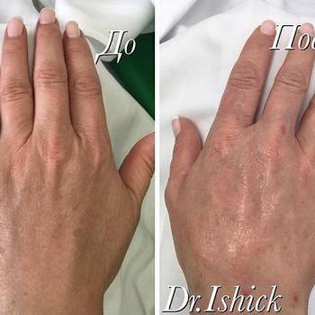 Ольга Ищик , Днепр Фото - 8