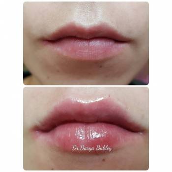 Фото с портфолио Дарья Бублей 