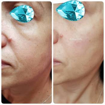 Фото с портфолио Дарья Бублей 