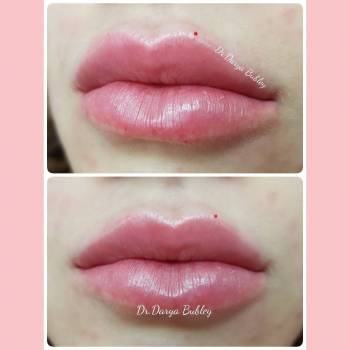 Фото с портфолио Дарья Бублей 