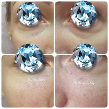 Фото с портфолио Дарья Бублей 