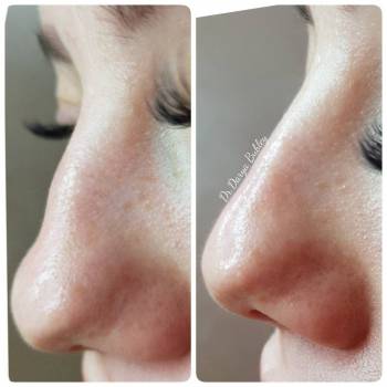 Фото с портфолио Дарья Бублей 