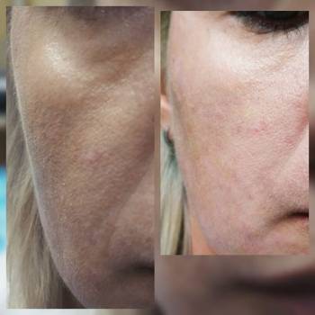 Фото с портфолио Дарья Зданевич