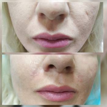 Фото с портфолио Дарья Зданевич