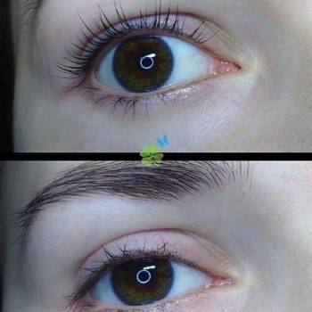 Фото с портфолио Артемис 