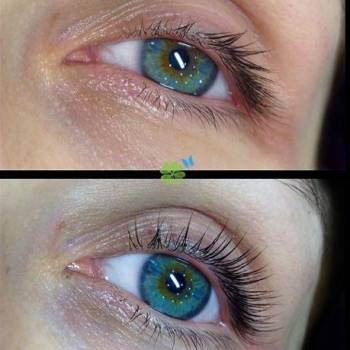 Фото с портфолио Артемис 