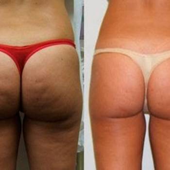 Андрей Данилюк , Київ Фото - 5