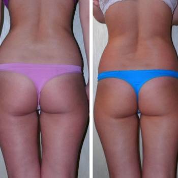 Андрей Данилюк , Київ Фото - 6