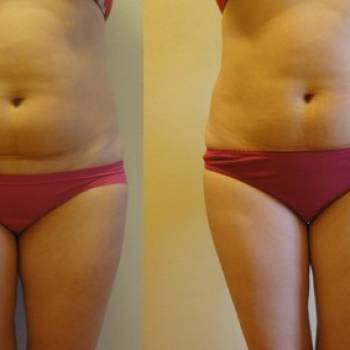 Андрей Данилюк , Київ Фото - 7