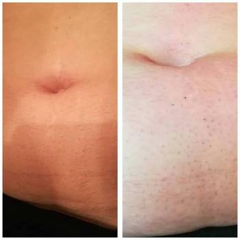 Body Line, Херсон Фото - 7