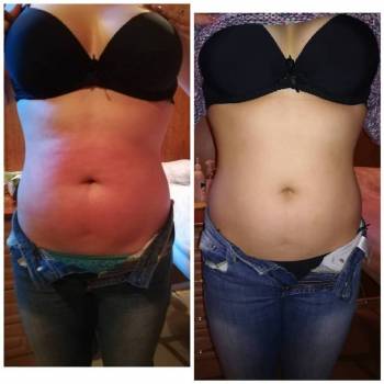 Body Line, Херсон Фото - 10