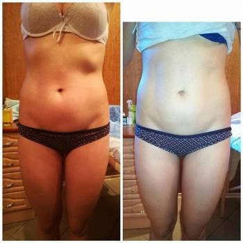 Body Line, Херсон Фото - 12