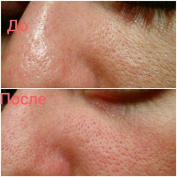 Ирина Столеру , Одеса Фото - 11