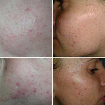 Фото с портфолио Янина Пиюк 