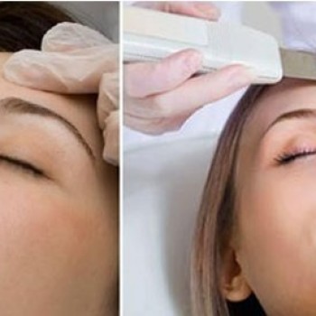 Комбинированная читстка лица