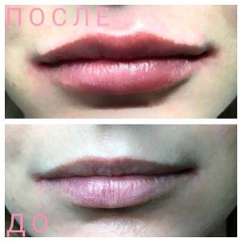 Алина , Кривий Ріг Фото - 5