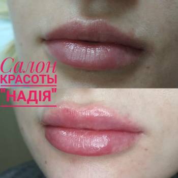 Алина , Кривий Ріг Фото - 6