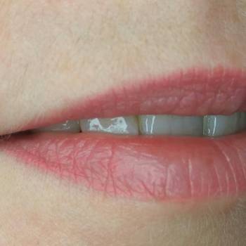 Зажившие губы через 2 месяца в технике "Акварель"