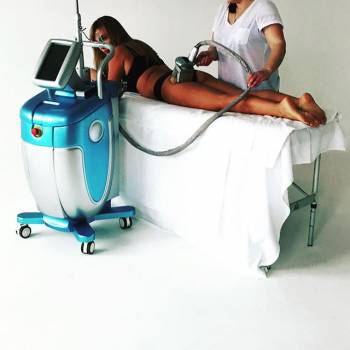 Процедура криолиполиза