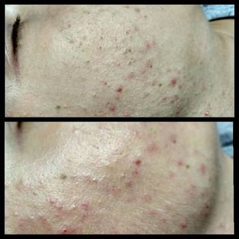 Алина Диброва , Запорожье Фото - 12