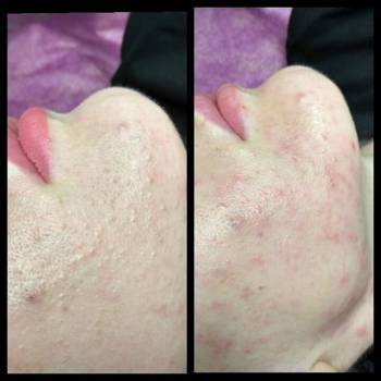 Алина Диброва , Запорожье Фото - 16