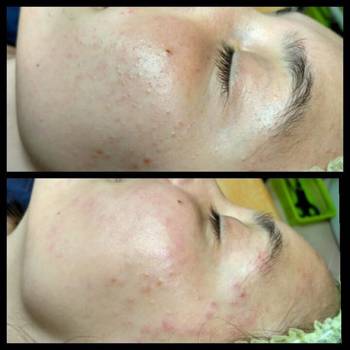 Алина Диброва , Запорожье Фото - 20