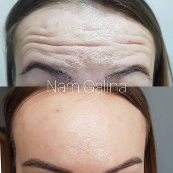 Нам Галина , Днепр Фото - 7