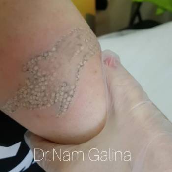 Нам Галина , Днепр Фото - 8