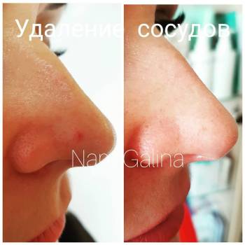 Нам Галина , Днепр Фото - 9