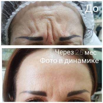 Нам Галина , Днепр Фото - 10