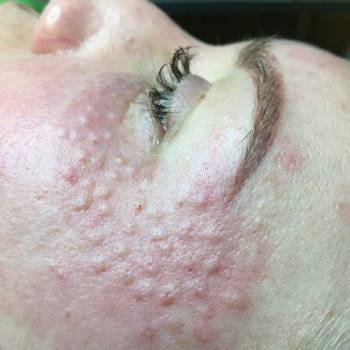 Руслана Апалькова , Київ Фото - 6