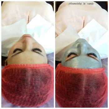 Фото из портфолио косметолога Антонина Шатковская (Винница)