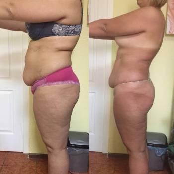 Юлия Богачук , Одесса Фото - 5